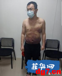 被绑台湾菜农称自己所有积蓄都被抢走，菲警还暖心免除医疗费用